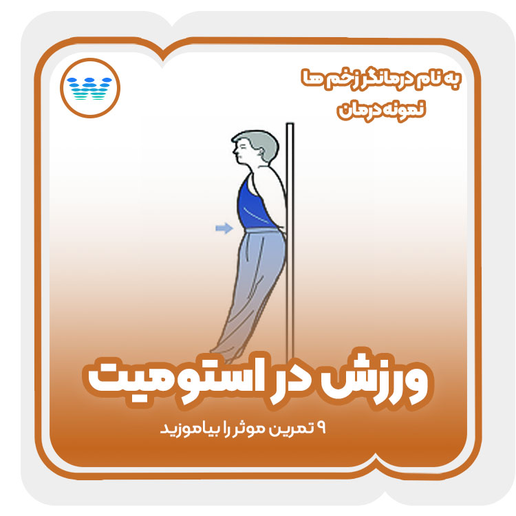 ورزش در استومیت