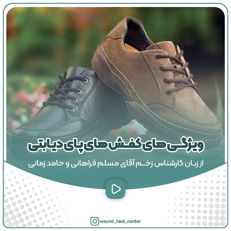 انتخاب کفش افراد دیابتی