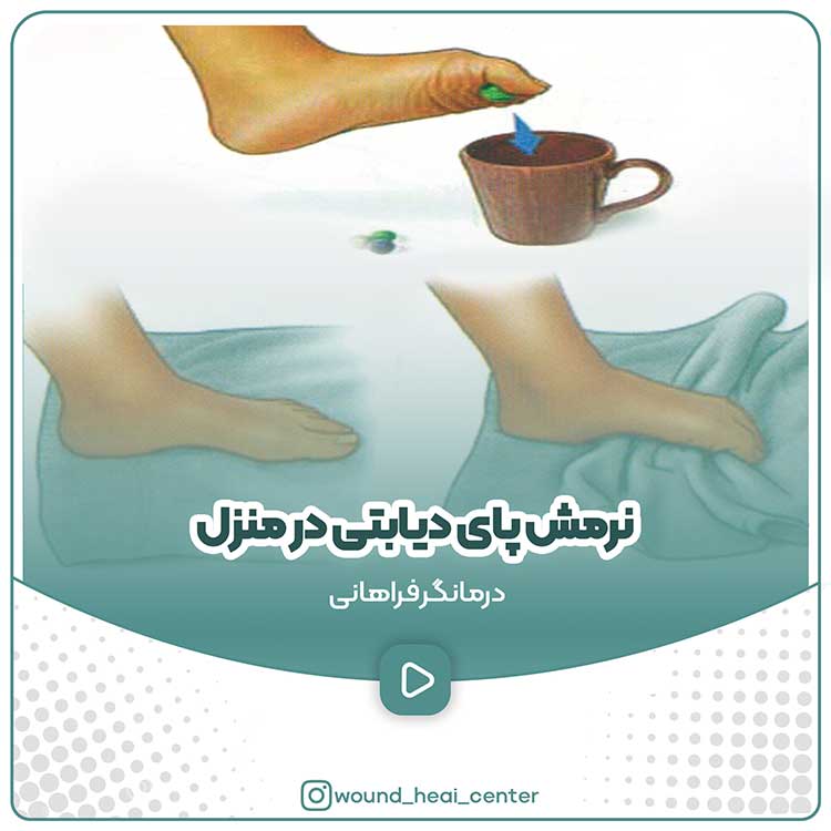نرمش پای دیابتی