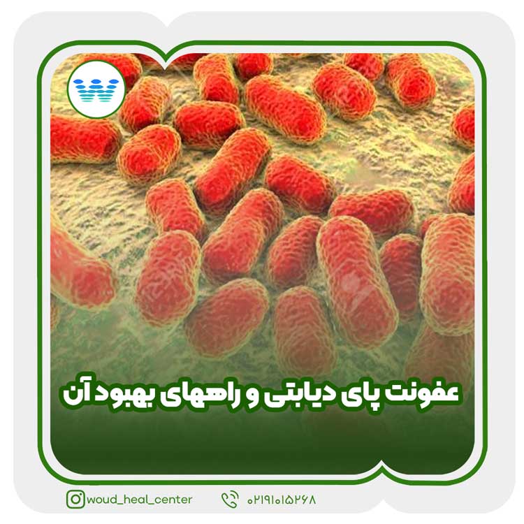 عفونت پای دیابتی و راههای بهبود آن