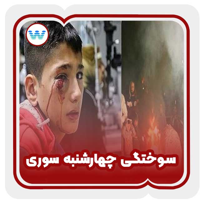 زخم سوختگی چهارشنبه سوری