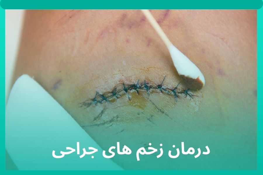 درمان زخم های جراحی