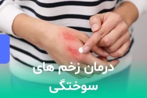 درمان زخم های سوختگی