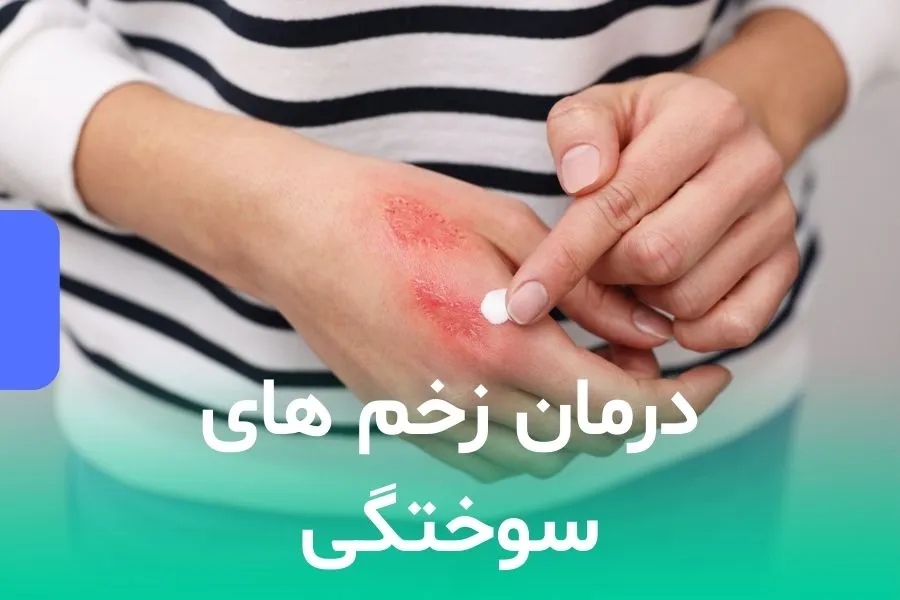 درمان زخم های سوختگی
