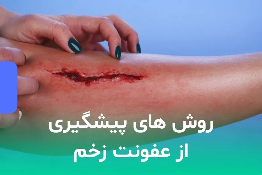 روش های پیشگیری از عفونت زخم