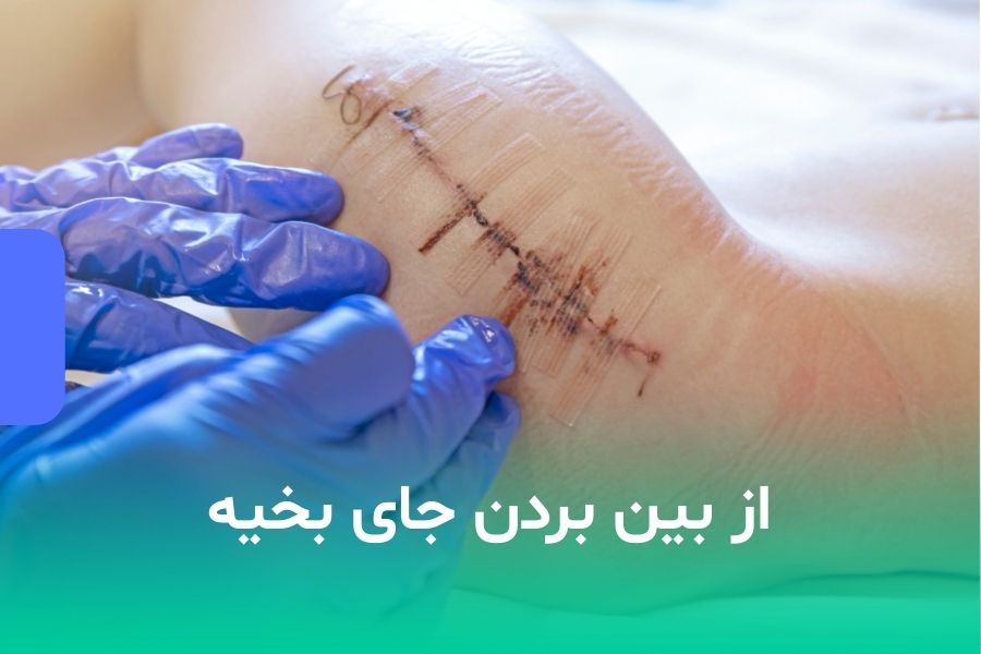 از بین بردن جای بخیه