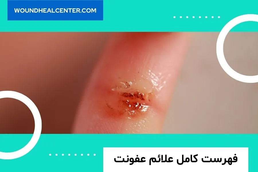 زخم های عفونی