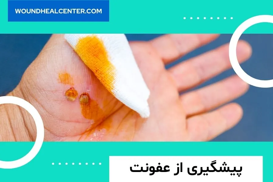 زخم های عفونی