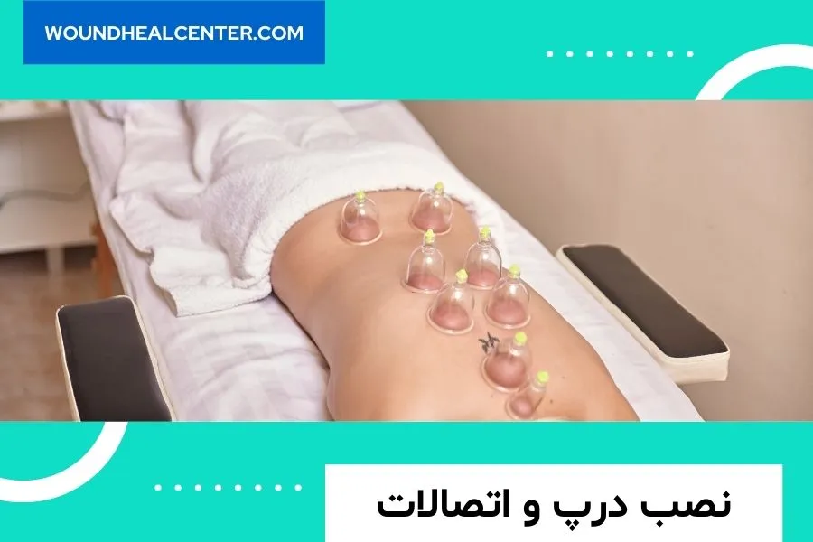 کیت وکیوم تراپی فاپسکو