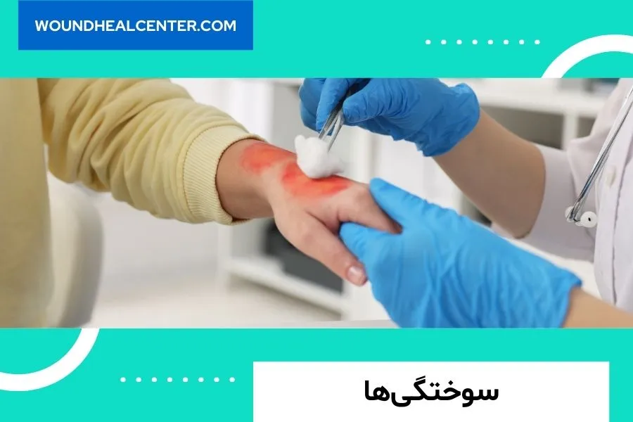 کیت وکیوم تراپی فاپسکو
