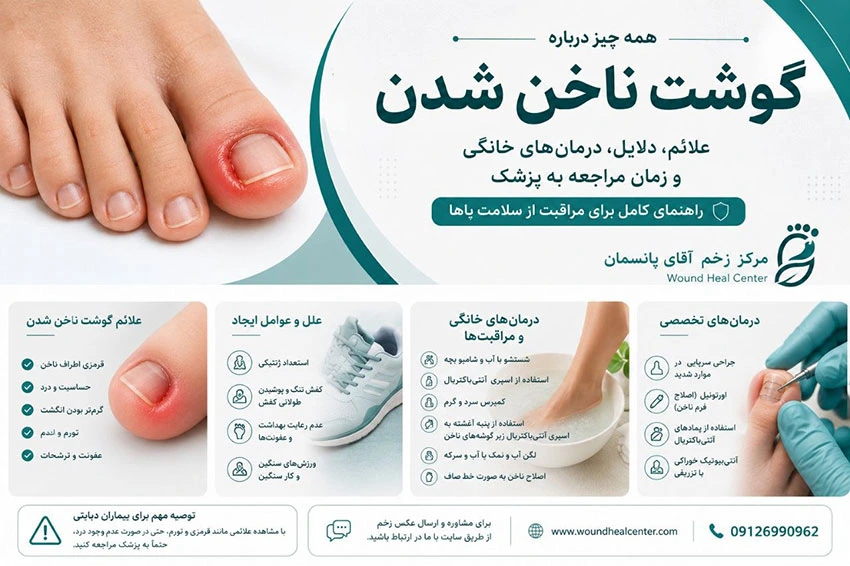 ناخنم تو گوشت میره، عمل کنم یا نه ؟